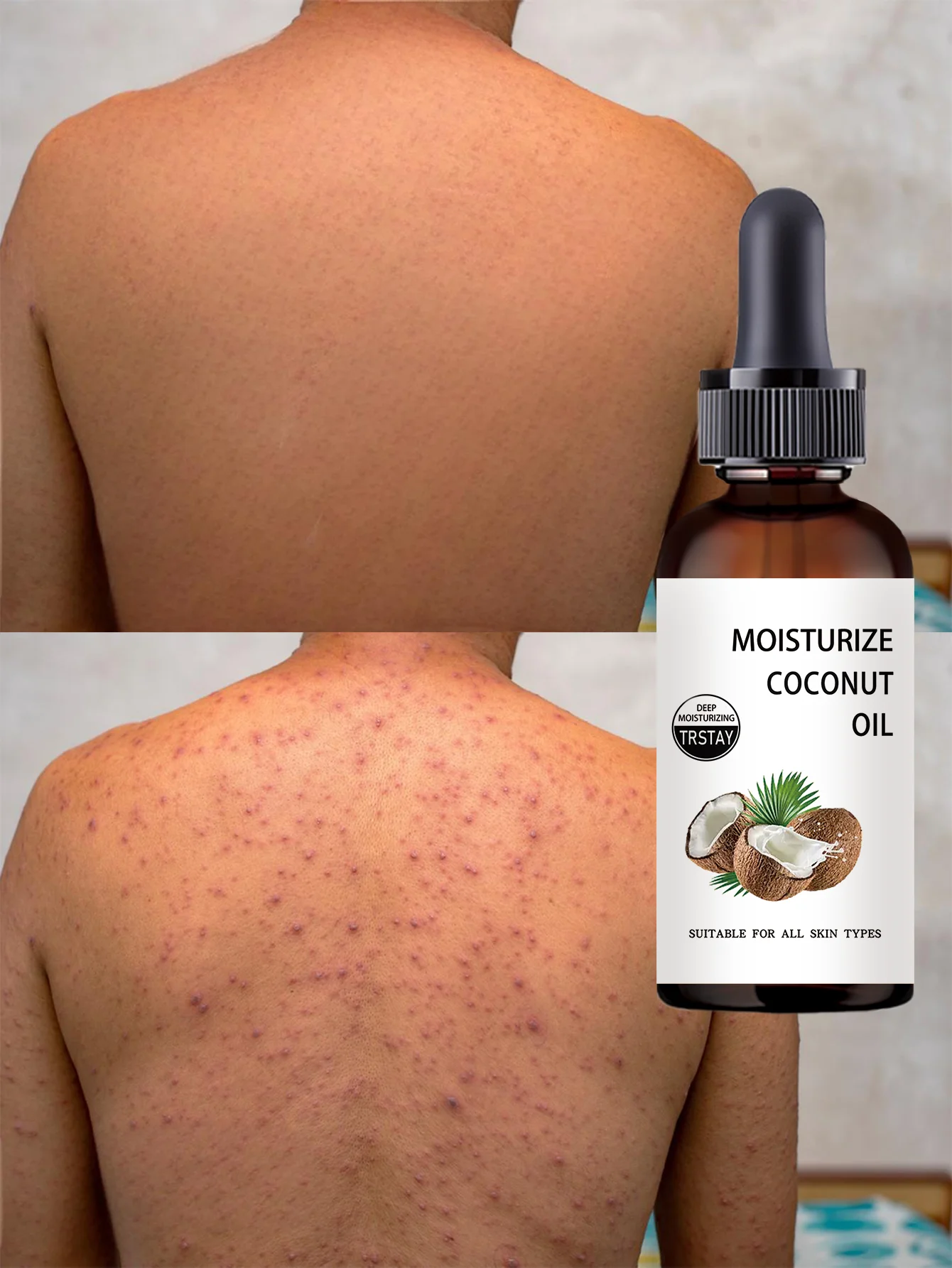 Unscented Body Moisturizing Oil with Vitamin E Formula for Long Lasting Hydration to Improve Dullness and Dryness Perfect for Da