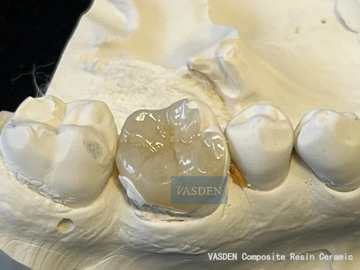 Vasden Cerâmica Híbrida Inlay Dental Composite Block em Odontologia, Disco Cerâmico Dental, Material CADCAM