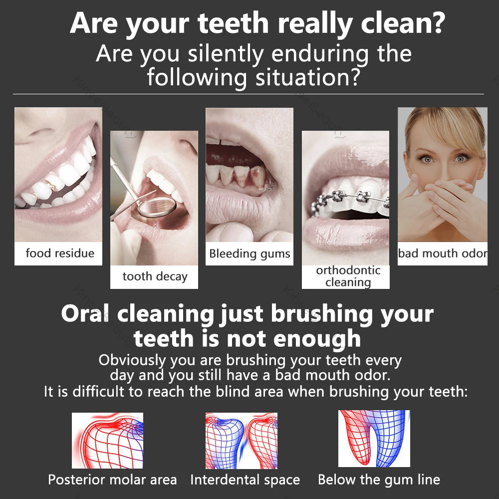 الري عن طريق الفم المحمولة مع حقيبة السفر USB قابلة للشحن 5 فوهات الأسنان الري 300 مللي خزان مقاوم للماء 5 طرق التسليم السريع