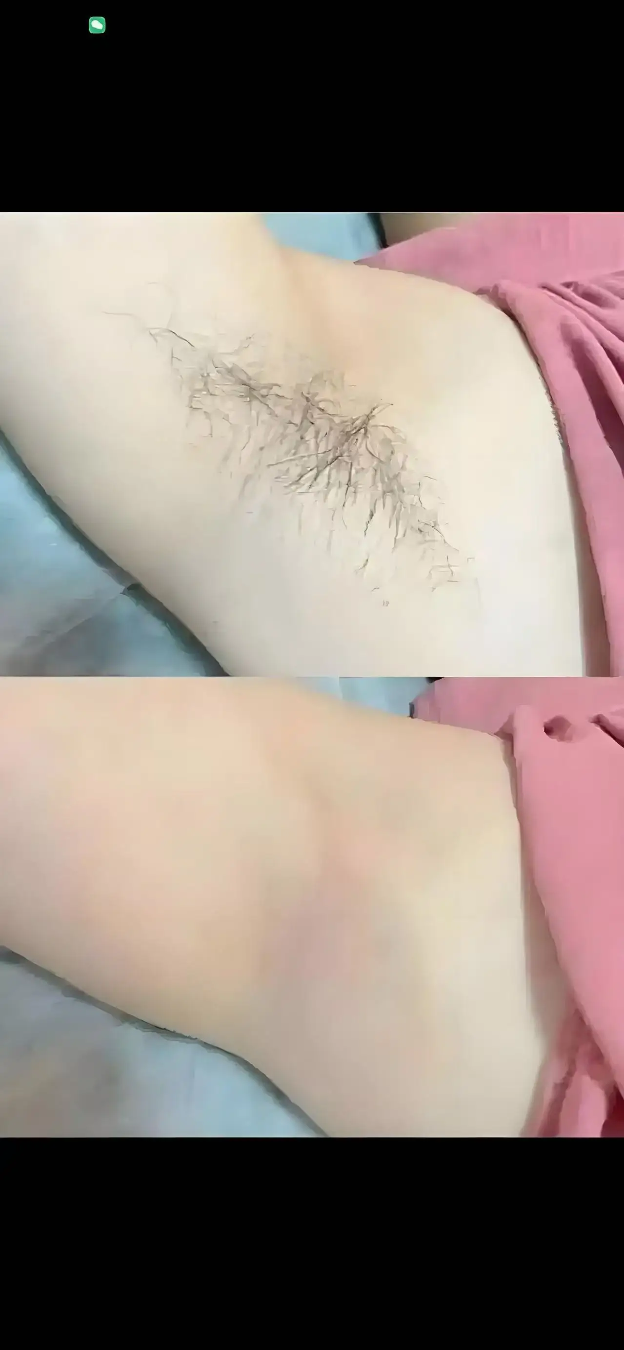 เครื่องกำจัดขนด้วยเลเซอร์ 2 in 1 โซปราโน ไทเทเนียม ไอซ์ แพลตตินัม ไดโอด 755 808 1064 นาโนเมตร 3 ความยาวคลื่น Nd:YAG กำจัดขนแบบไม่เจ็บ