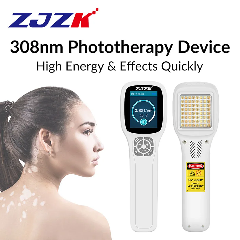 Powerful Uvb 308nm Lamp Phototherapy Equipment 450mW Portable Light Therapy Machine For Psoriasis Vitiligo EczemaTreatment