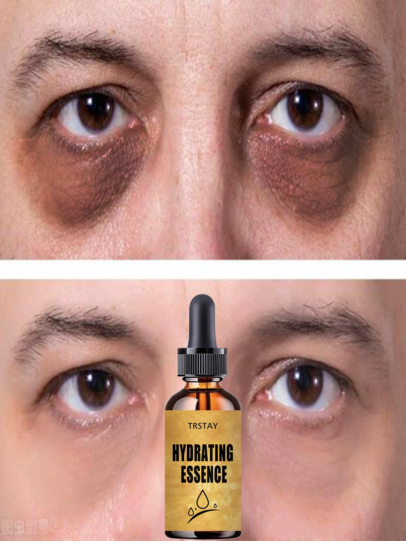 Moisturizing Vitamin E Eye Oil for Brightening and Smoothing All Skin Types Eye Care Solution to Hydrate and Nourish Delicate Ey - Image 4