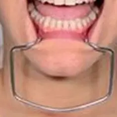 

Стоматологический ортодонтический открывалка для рта из нержавеющей стали, стоматологический ретрактор для губ и щек, стоматологический интраоральный расширитель, инструменты