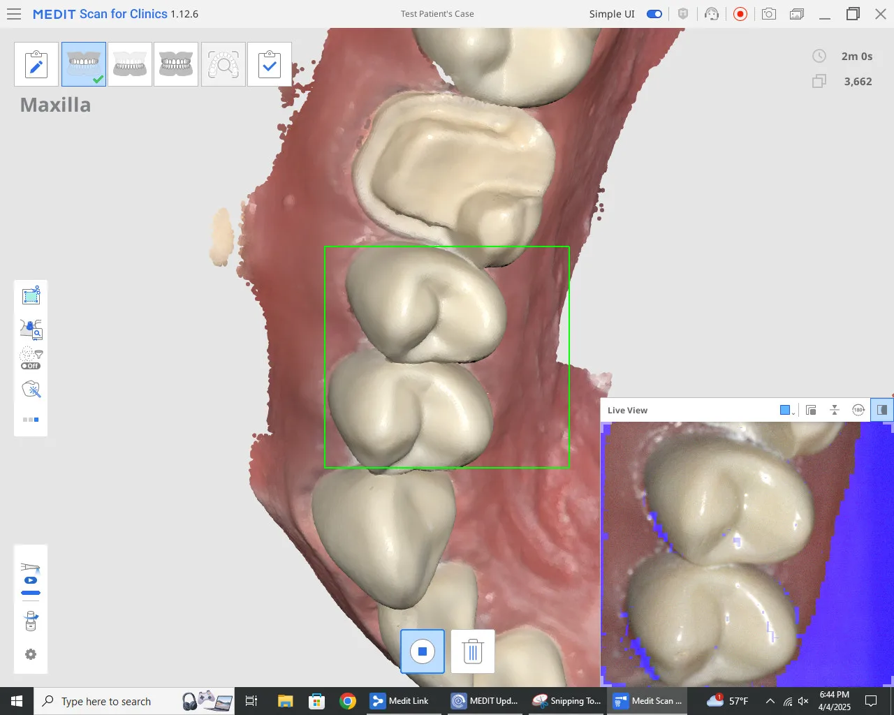 KIC 2021 Medit i700 ماسح ضوئي وملحقات سلكي داخل الفم (AZ2112100055) اشتر 5 واحصل على 1 مجانًا 9826VFD52 #6