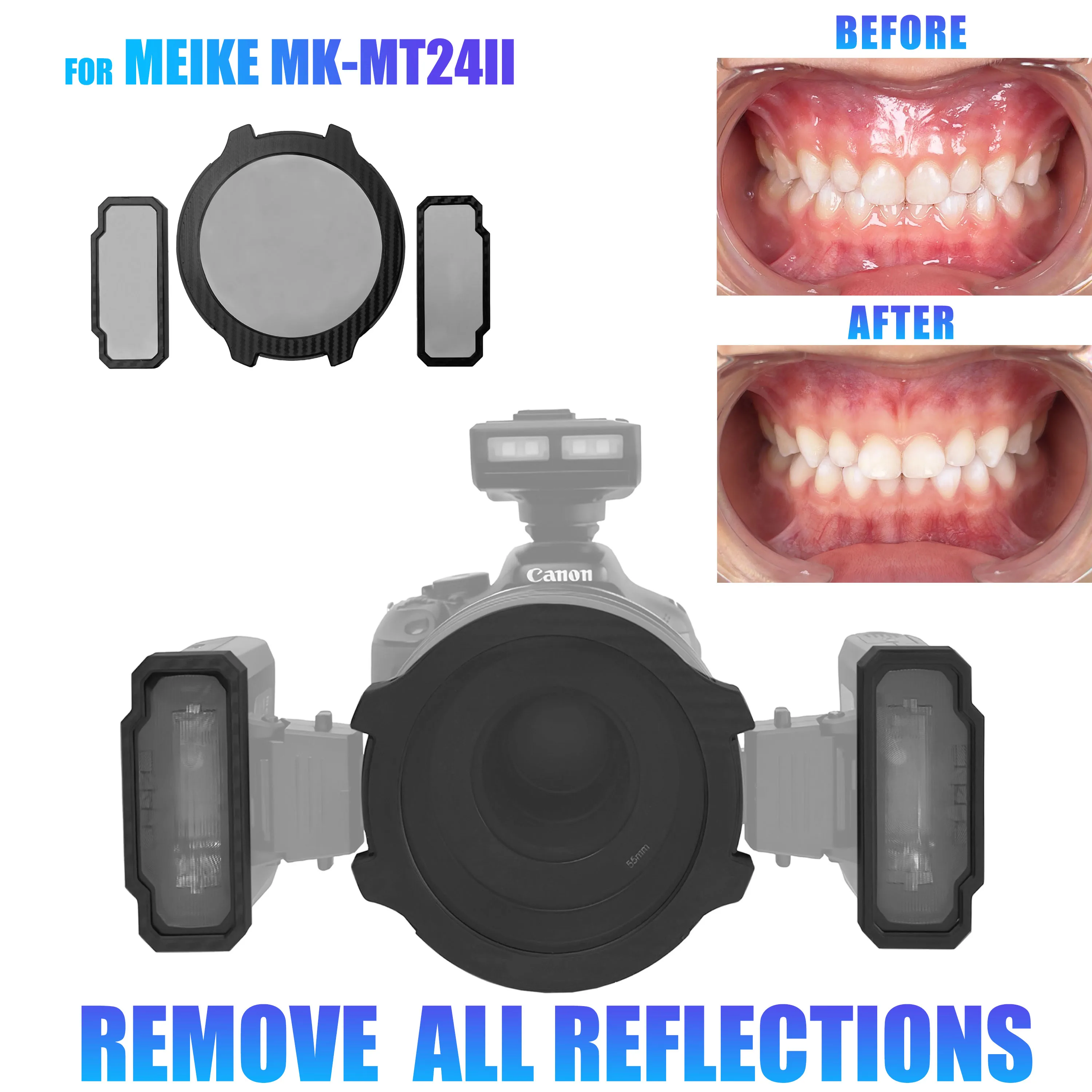 ProfessionalCrossPolarizer Kit for MEIKE MK-MT24II Flash Remove Glare Preserve Tooth Texture Dental Colorimetry Crowns Dentures