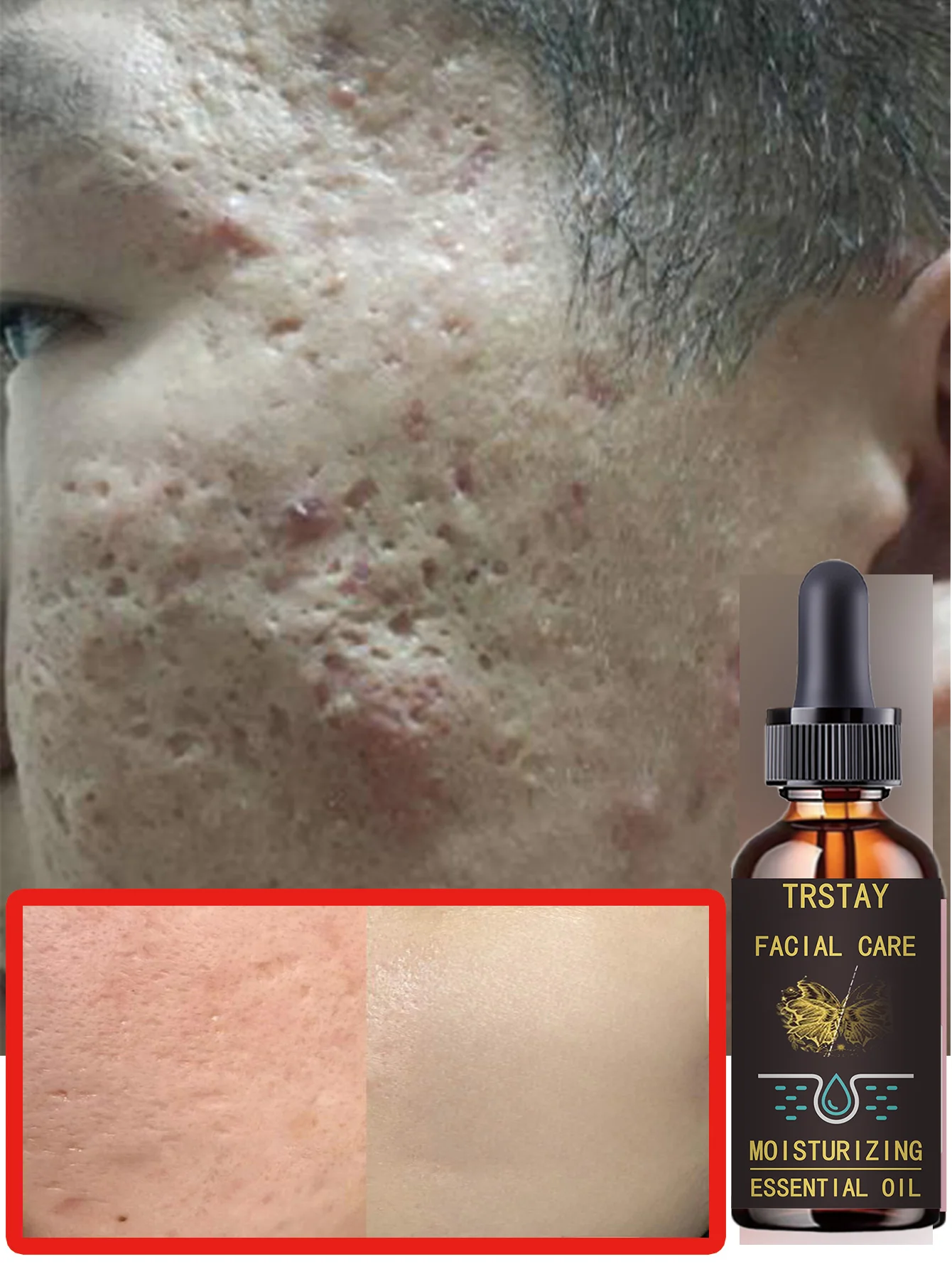 Deeply Moist Anti Wrinkle Essence Milk for Tender Skin with Whitening Benefits Hydration Treatment to Improve Skin Texture and P - Image 3