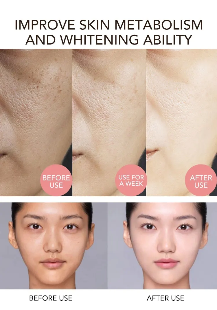 AILKE Superior Lighten Vitamin C Face Serum, Moisturizes, Hydration, Remove Hyperpigmentation, Black Spots, Freckles, Clean Skin