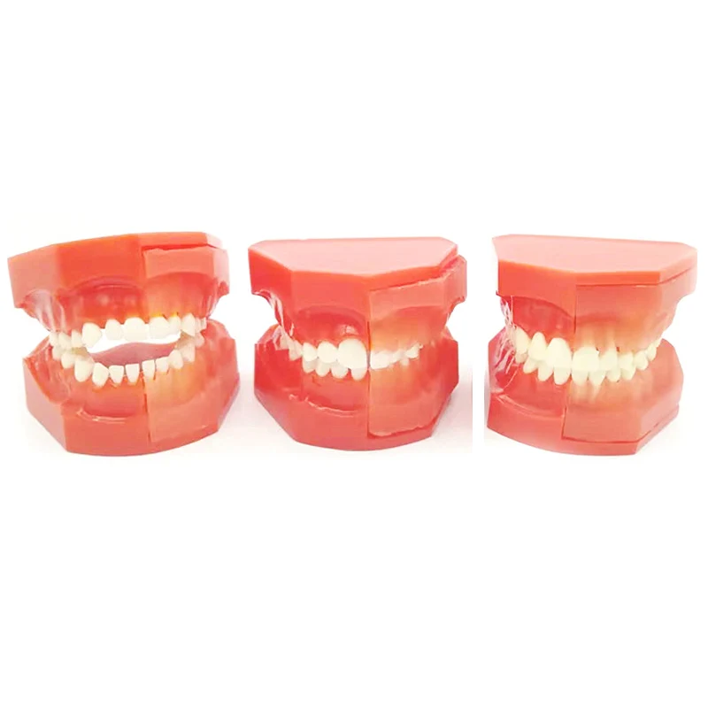 Dental Oral Teaching Model Children's Primary And Permanent Teeth Alternate Model Deciduous Teeth Replacement Teeth Development