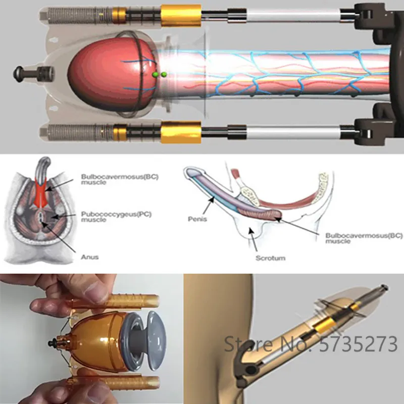 Penis Extender SizeDoctor Penis Enlargement STRETCHER System Kit Doctor Size for Extender Penis Pump