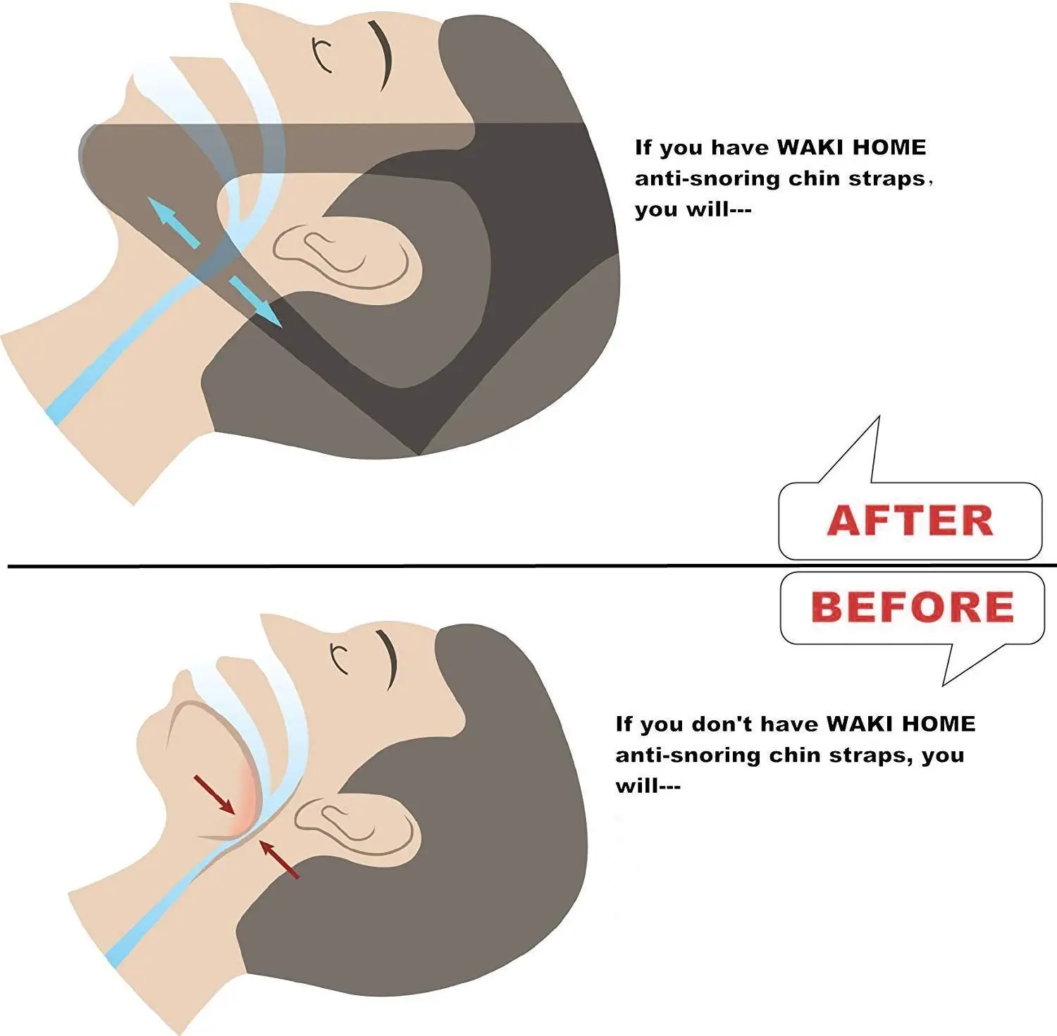 หยุด Snoring เข็มขัด Snore Stopper ป้องกันการนอนกรน Dislocated Snoring แถบความต้านทาน Chin ยึดสายรัดคาง Dislocation Band