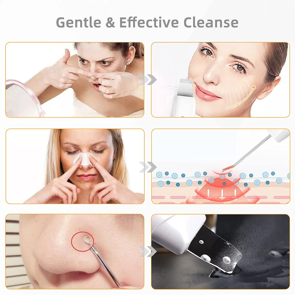 Ultrasonic Skin Scrubber Face Spatula Shovel Ion Deep Face Cleaning Blackhead Removal Pore Cleaner Face Lift Beauty Machine