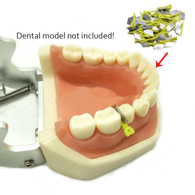 Cuchillo de cuña Dental de 40 piezas, protector de cuña de plástico interpróximo con matriz de acero inoxidable, Matrices de odontología