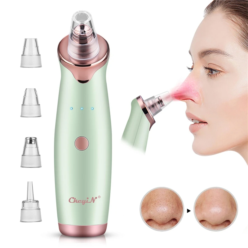CkeyiN Ultrasonic Facial Skin Scrubber Ion Deep Face Clean + Electric Vacuum Suction estrattore di punti neri strumento pulito con 4 sonde