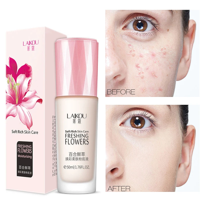 Lily Flower Extract Liquid Foundation Long Lasting Oil-Control Moisturizing Cover Up Blemishes Improve Gloss Makeup Cosmetic