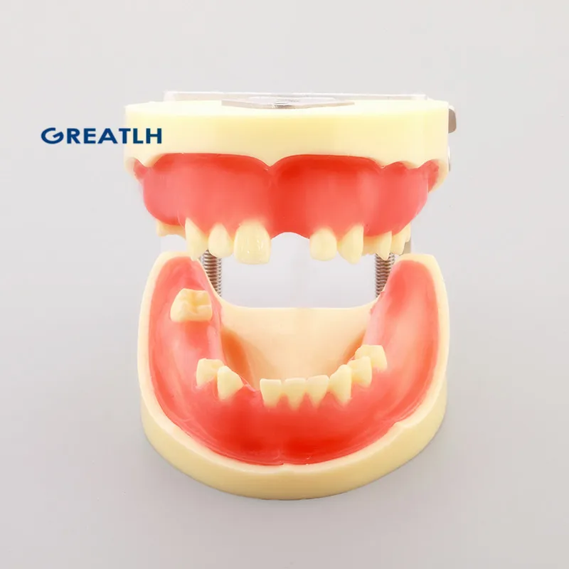 Dentistry Practice Implant Teeth Model for cutting and suturing practices Teeth Implant Practice Model Missing Teeth M2002