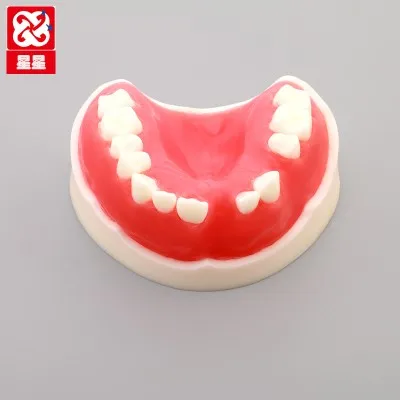 

Periodontal suture Then disease Practice Model Planting missing Oral dental model free shipping