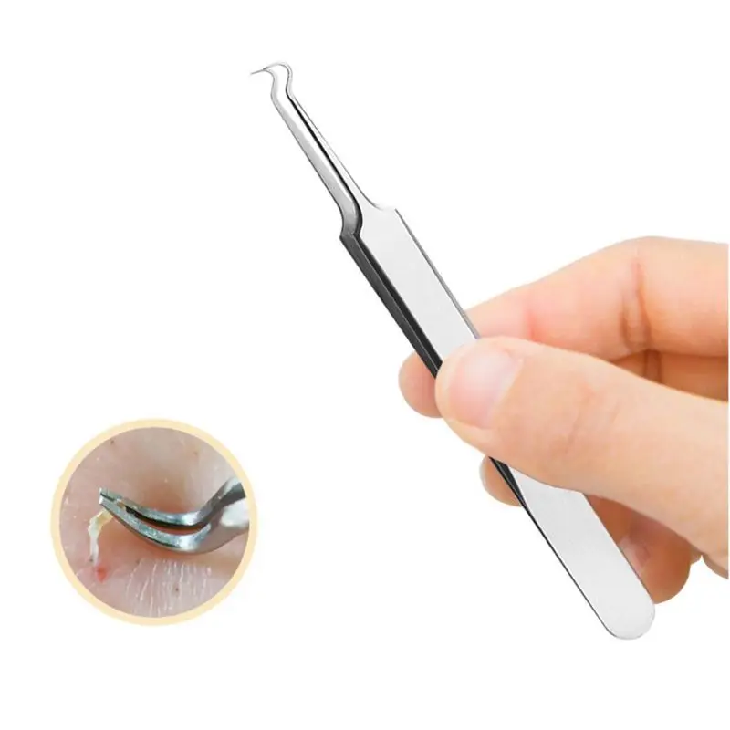 สแตนเลสสตีล Blackhead แหนบสิว Comedone Remover Nipper โค้งโค้งหัวทำความสะอาดใบหน้าสิวคลิปเครื่องมือความงาม