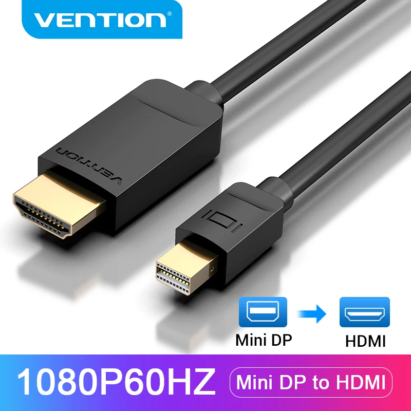 Vention Mini DisplayPort to HDMI Cable 1080P Mini Display Port Male to HDMI Male Cable for HDTV Apple MacBook Mini DP to HDMI