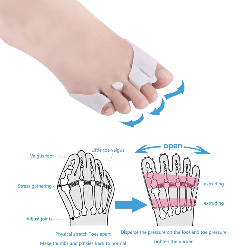 1 para silikonowe przednie stopy klocki dla palucha koślawego kciuk Bunion korekta palce nakładanie Separator palców stopy łagodzi ból stóp pielęgnacja stóp