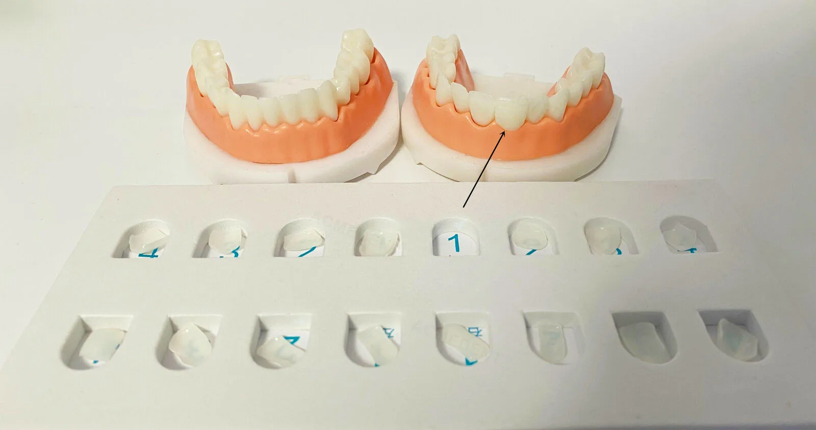 

Dental Composite Veneer Template Model Practise Veneers Dentist Teaching