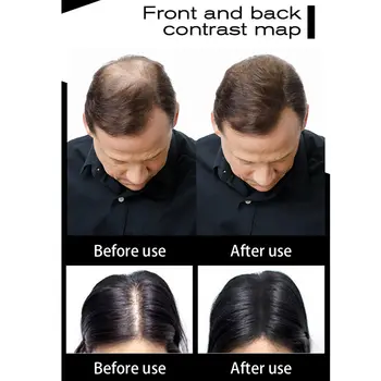 Sevich 100公克增髮纖維補充裝,適用於禿頭接髮、生髮粉、沙龍專業護髮、男女通用防脫髮產品 8 最佳銷售 塞維奇髮粉 - №7