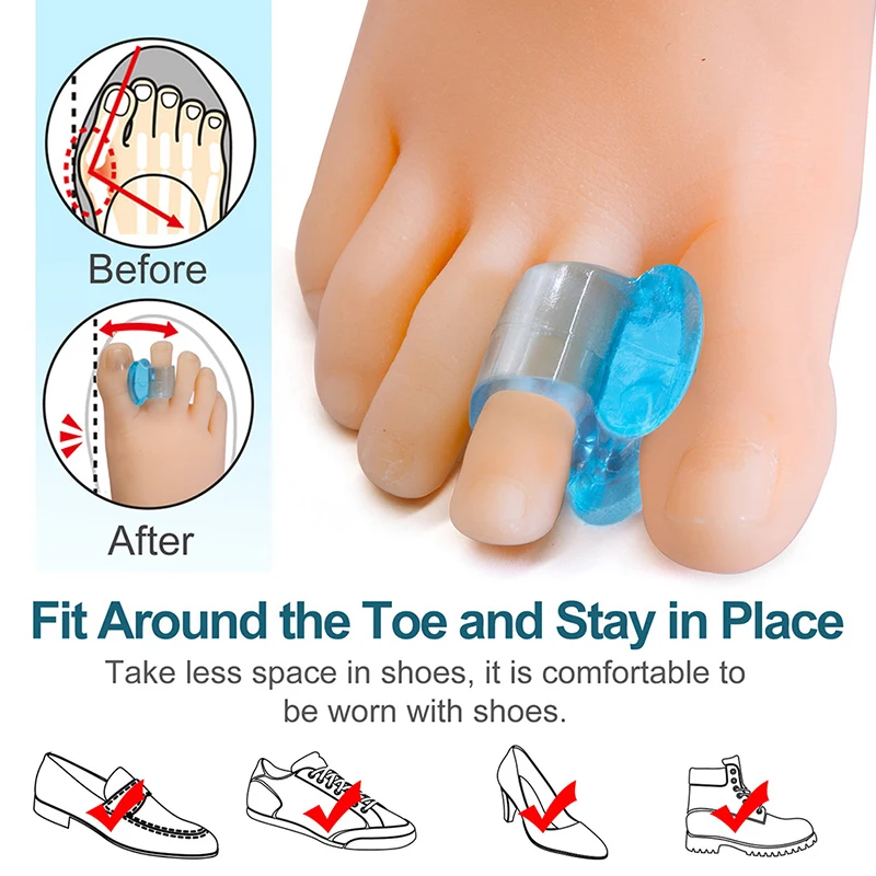 2Pcs=1Pair Silicone Toes Separator Bunion Bone Ectropion Adjuster Toes Outer Appliance Foot Care Tools Hallux Valgus Corrector