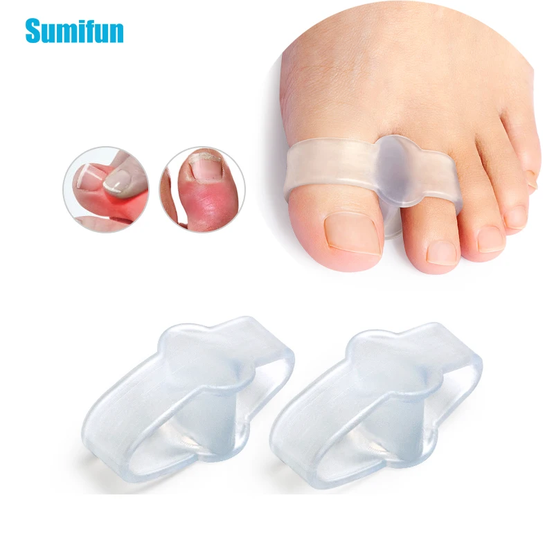 2pcs Transparent Toe Seprateor Hammer Toe Straightener Prevent Toe Overlapping Bunion Thumb Separator Orthotics Foot Care Tool