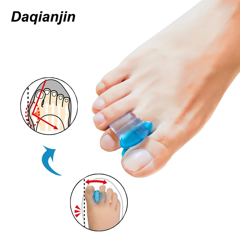 1 Paar Zachte Siliconen Teen Separator Duimen Orthesen Bunion Behandeling Hallux Valgus Correctie Pedicure Spacers Voetverzorging Tool