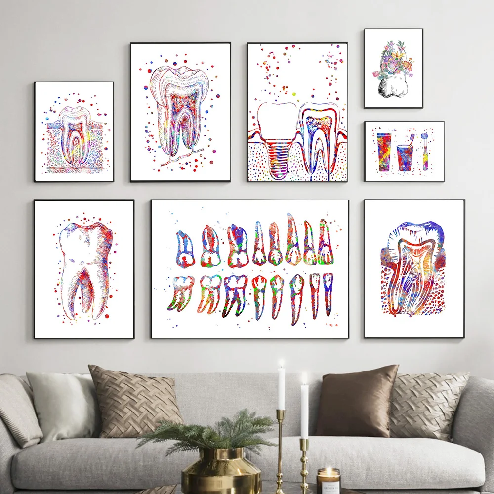 Tooth Implant Canvas Painting Dental Art Poster Medicine Anatomy Print Dentist Gift Wall Art Posters Picture Clinic Office Decor