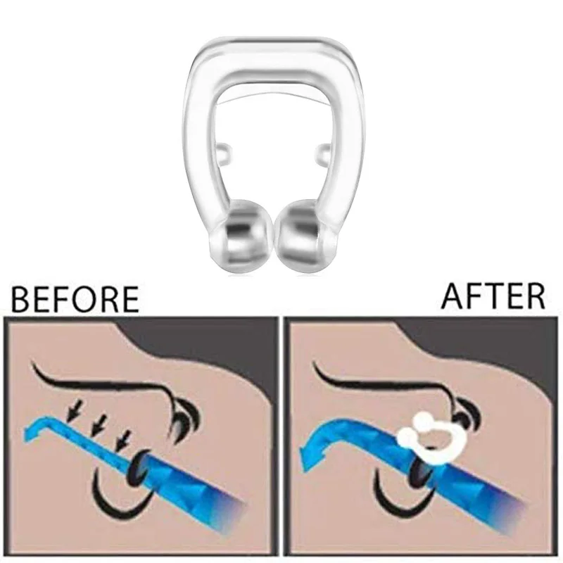 Anti Snoring Device Noseclip Stopper Snore Remedy Products Stop Clips Dilatador Nasal Nose Ronflement Ronquidos Snurk Snurken