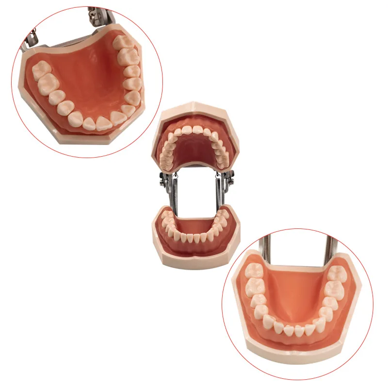 Modello dentale denti modello denti in gomma modello didattico Standard typonon dentale modello dimostrativo con dente rimovibile 200H