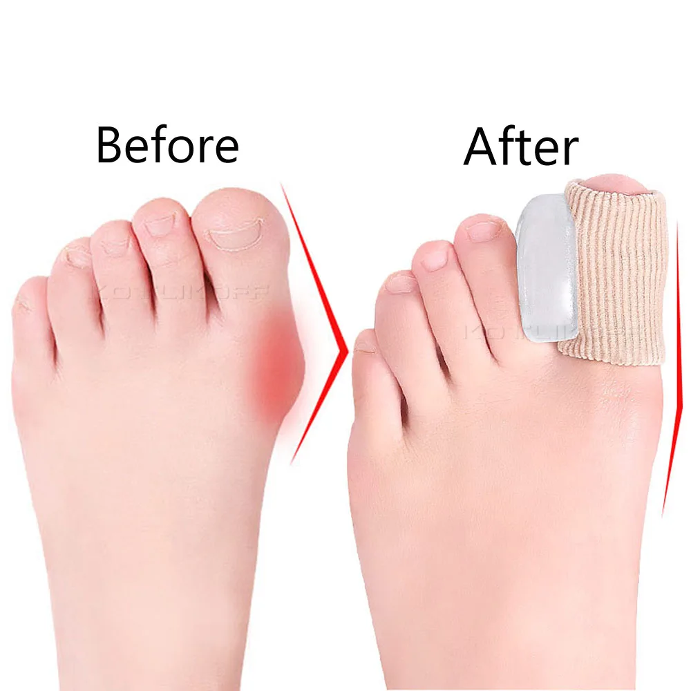 2Pcs Silicone Foot Toe Separator Adjuster Hallux Valgus Pedicure Corrector Feet Care Bunion Bone Thumb Valgus Protector Tool