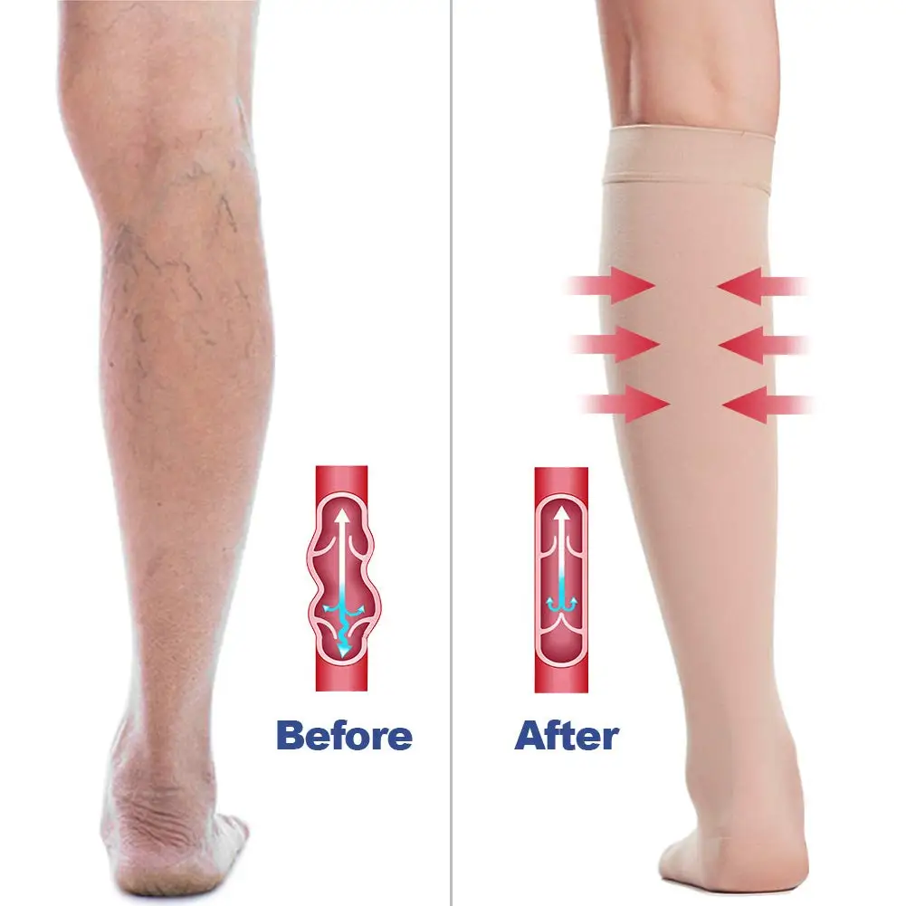 Open Toe Knee High Calf Compression Socks Women & Men Firm 20-30 mmHg Graduated Support  for Varicose Veins Edema Flight Socks image 3