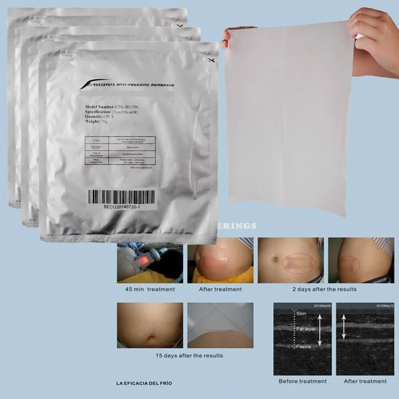 27*30Cm Antifreeze Membranes Anti-Cooling Freeze Fat Pad Bag For Cold Therapy 100Pcs For Skin Protection No Frostbite