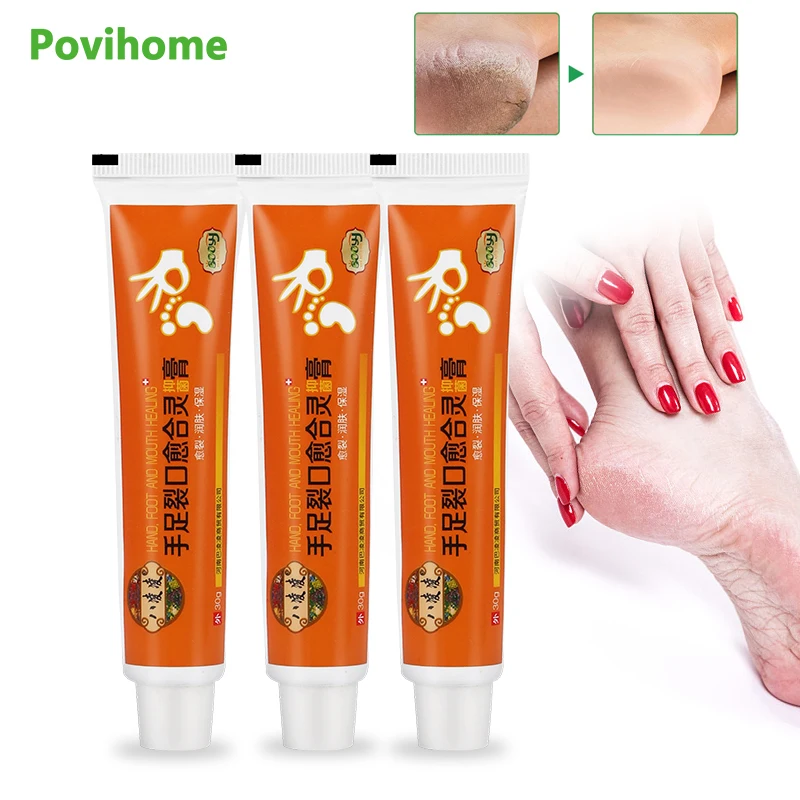 

1/3pcs 30g Powerful Hand Foot Crack Cream Heel Chapped Peeling Foot And Hand Repair Anti Dry Crack Skin Care Chinese Ointment