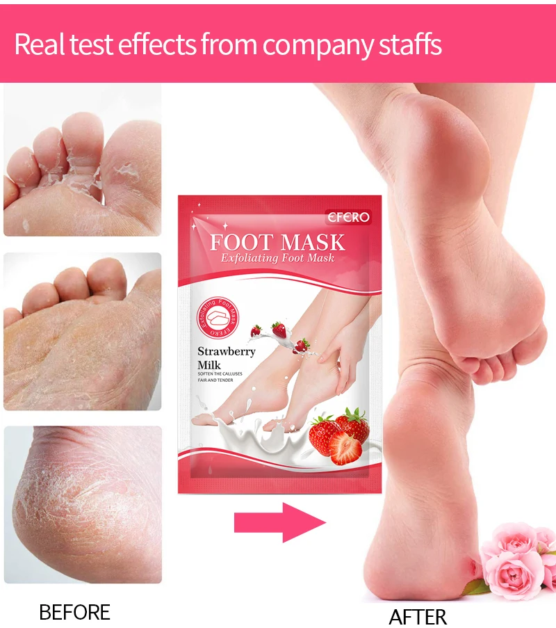 30pairs Exfoliating Foot Masks Pedicure Socks Strawberry Milk Exfoliation for Feet Mask Remove Dead Skin Heels Foot Peeling Mask