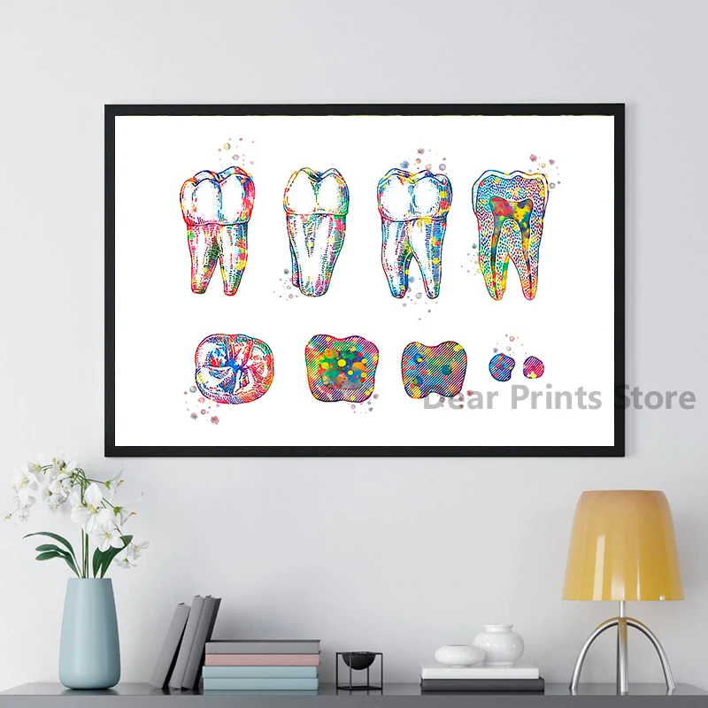 Tooth Implant Art Dental Crown Print Dentist Gift Tooth Anatomy Medical Wall Art Canvas Painting Picture Dental Clinic Decor