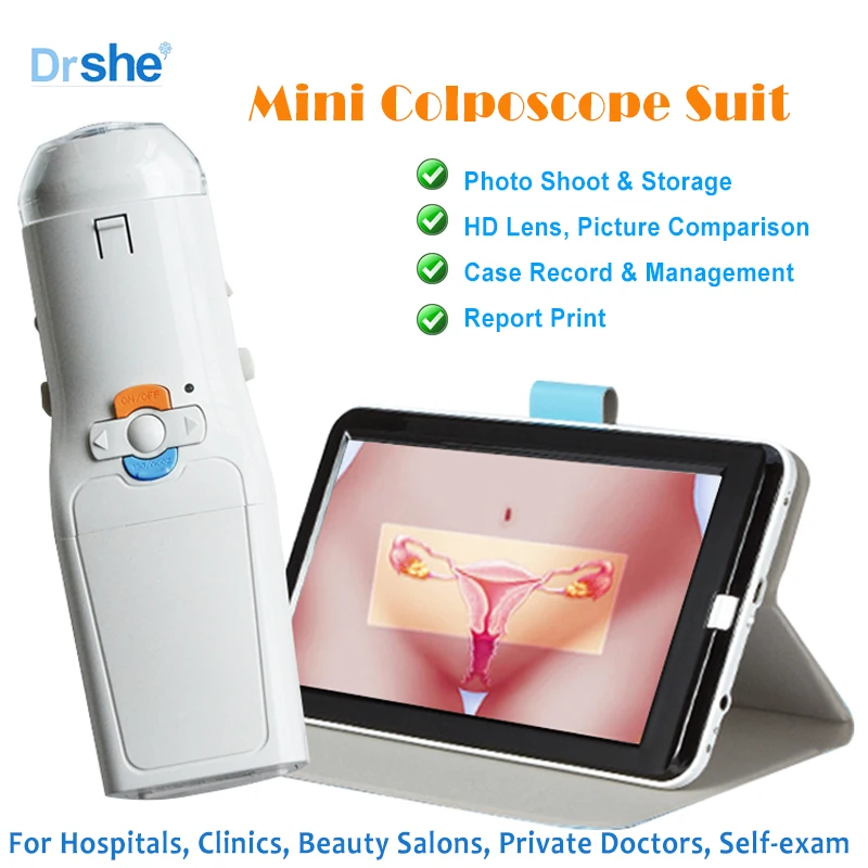 Portable Digital Video Electronic Mini Colposcope FA2 3000 000 Pixels with Display Screen Sunny Medical Miniscope Suit SEYES