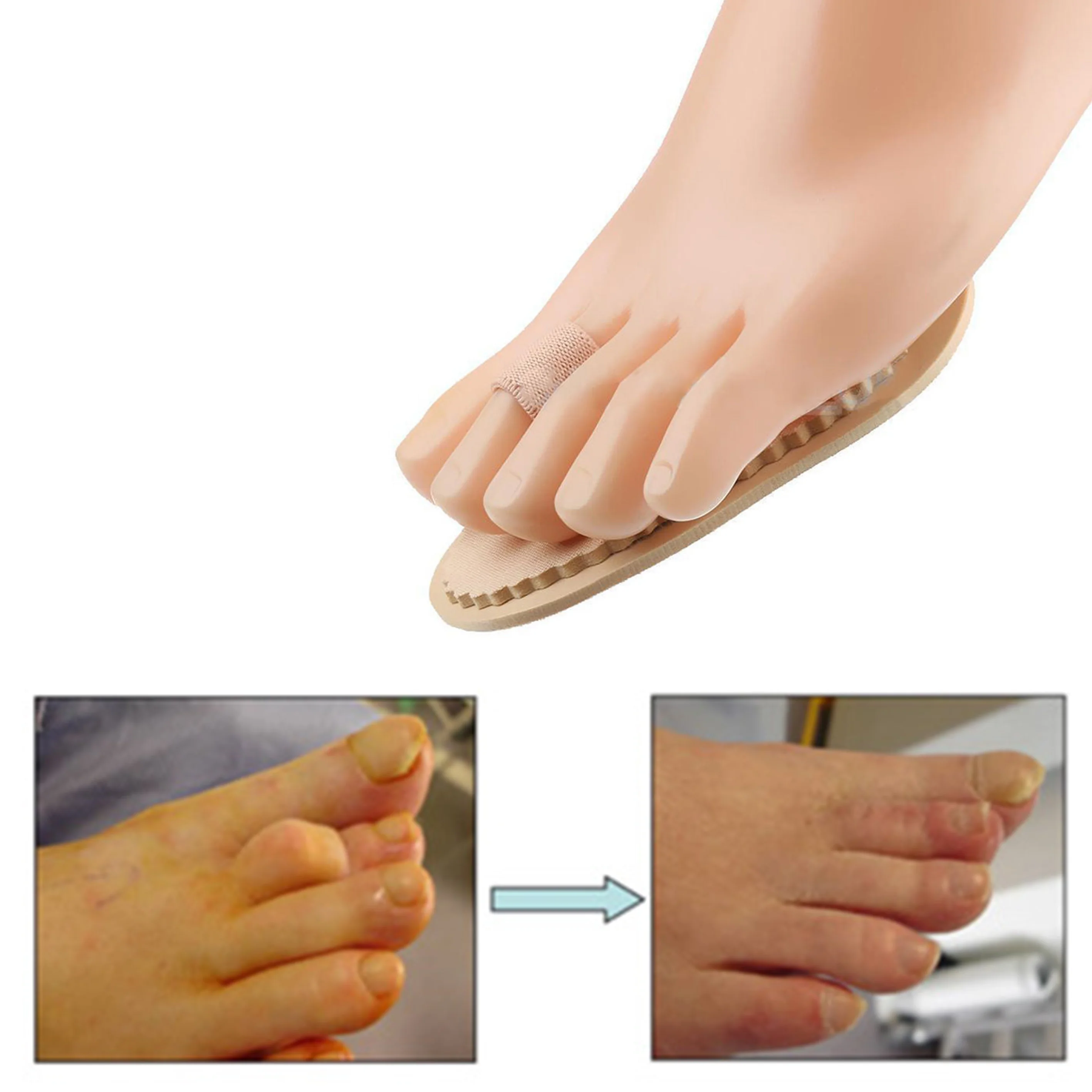 Picture 6: 1Pc Hammer Toe Cushions Protector Separator Support Pads Temporary Corrector Straightener Bunion Guard EVA Foot Care Tools