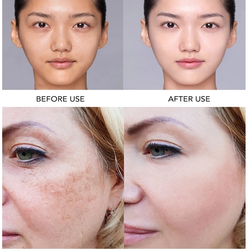 Zdjęcie 3: AILKE Superior Lightening Face Serum, nawilża, odżywia, usuwa przebarwienia, wyrównuje koloryt skóry, oczyszcza skórę z witaminą C