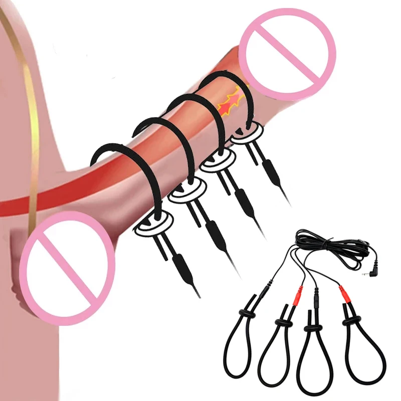 פרניס רינג – סקירת מוצר מפורטת וטיפים שימושיים