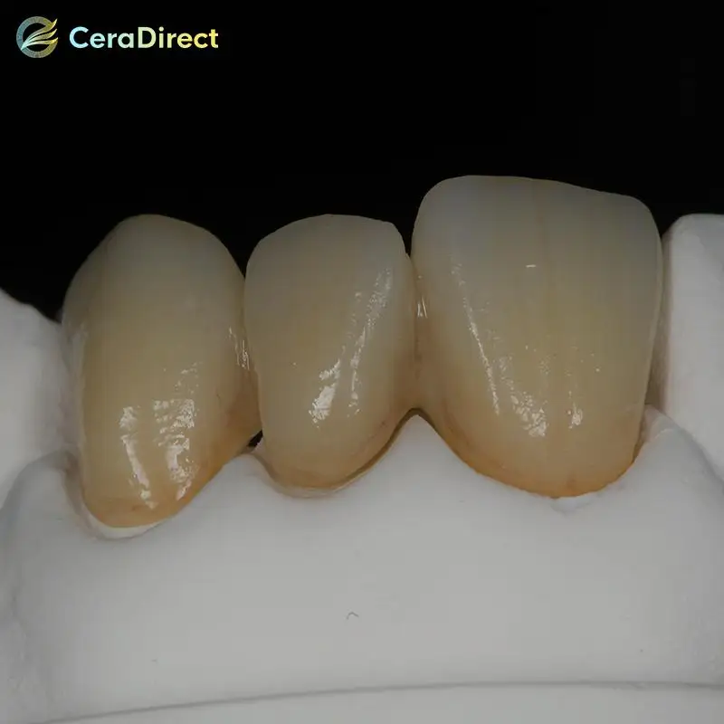 Ceradirect-SHTML Multicouche contre-indiqué, Conia pour contre-indiqué, Kon Zahn System, 95mm, Épaisseur 20mm, CAD de laboratoire dentaire, Capture d'écran