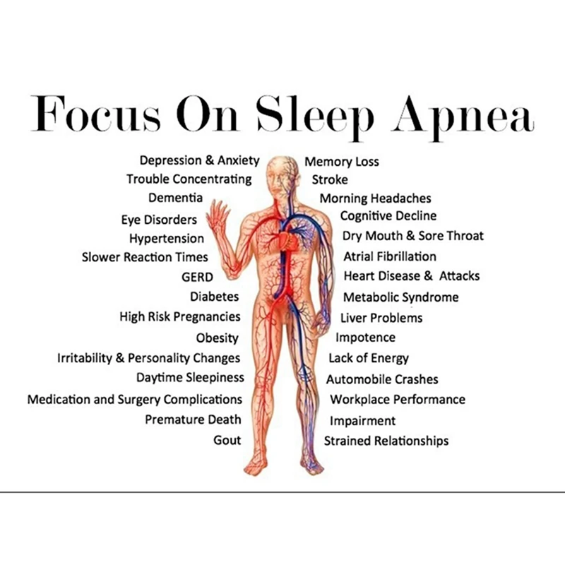 Filtro Viral bacteriano CPAP de 1 pieza, 10X10Cm, 5 piezas, 13Mm, filtro CPAP, alérgenos virales en el aire