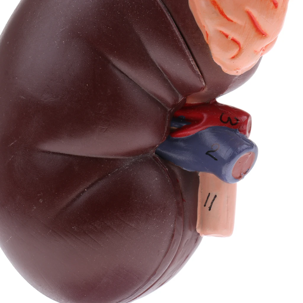 1:1 Lifesize Kidney Model Removable 2 Parts Kidney with Adrenal Gland Anatomical Model (with Base) for School Lab Tool Kits