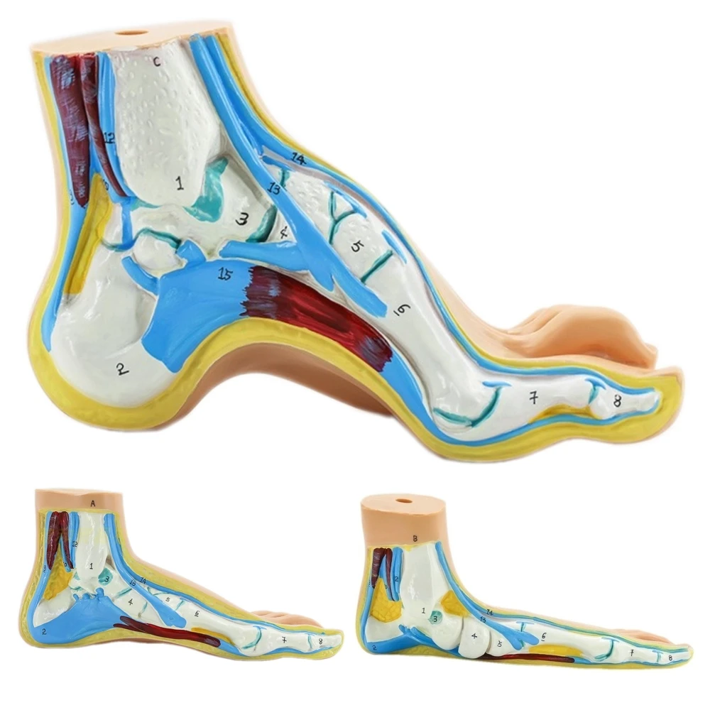 Human Foot Model Foot Muscles Normal Foot Flat Foot Arched Foot Model  Foot Muscle Anatomy Model Medical Science Teaching Model