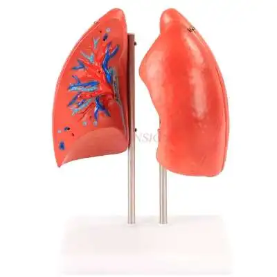 

Lung model medical aids lung breathing lung segment model human lung planing model