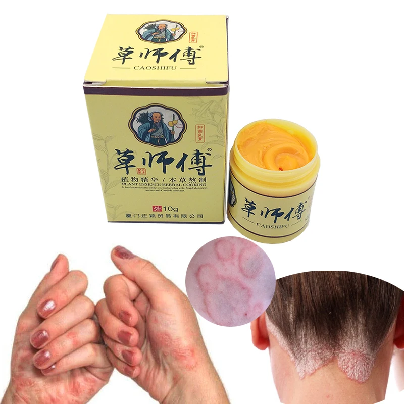 

5pcs Psoriasis Eczma Cream Works Perfect For All Kinds Of Skin Problems Patch Body Massage Ointment Chinese herbal Medicine