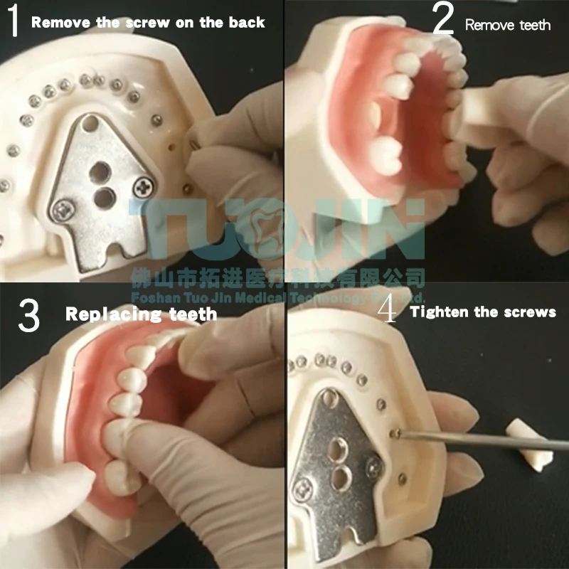 Dents dentaires en résine, 1 ensemble de 28 pièces, modèle en plastique de remplacement, fuchsia, produit de laboratoire dentaire