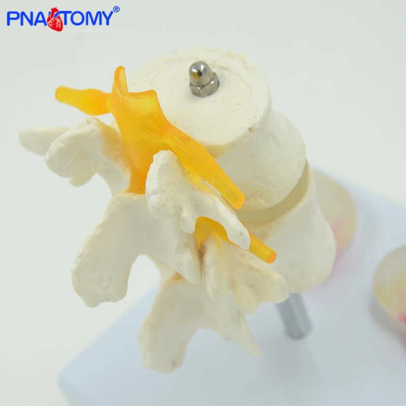 

Life Size Human Lumbar Vertebrae Model Vertebra Lumbalis Intervertebral Disc Anatomy Skeleton Medical Teaching Tool PNATOMY