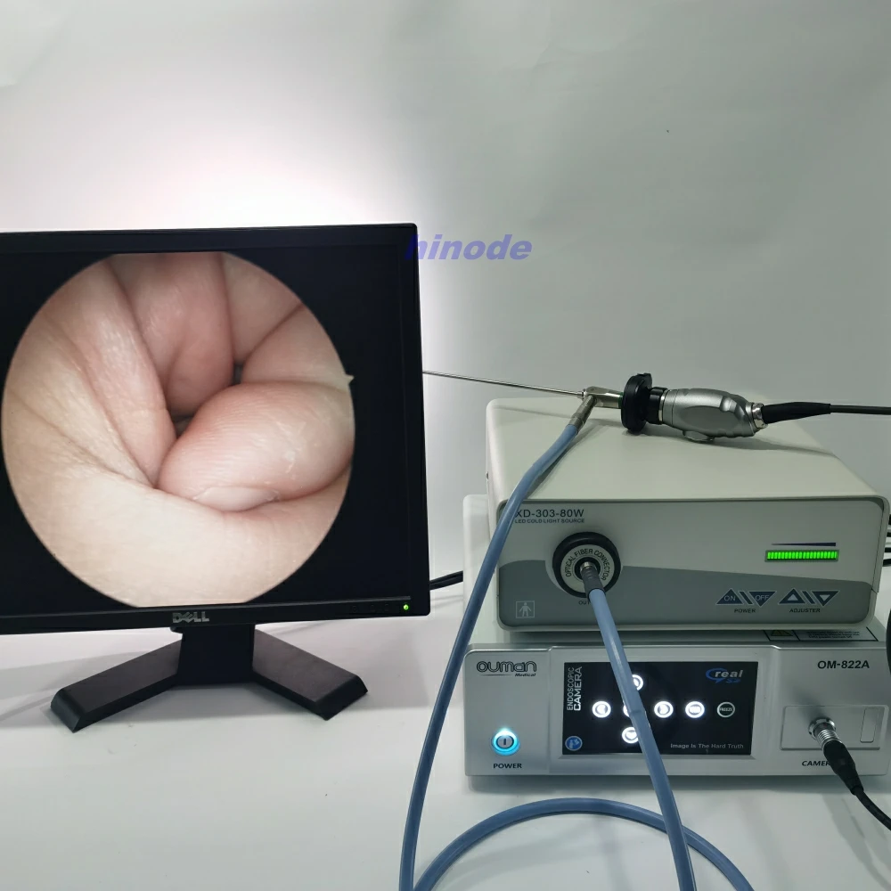 Videocamera per endoscopio chirurgico medico orl HD Ouman 822A